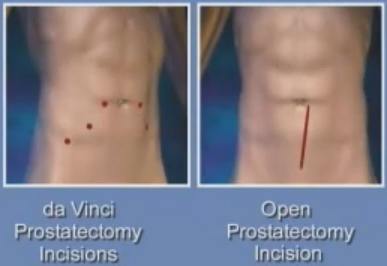 large cut vs 5 small cuts